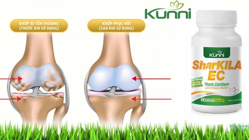 Viên Uống Sụn Cá Mập Hỗ Trợ Điều Trị Xương Khớp 1000mg Kunni SharKILA EC (Bao tan trong ruột)